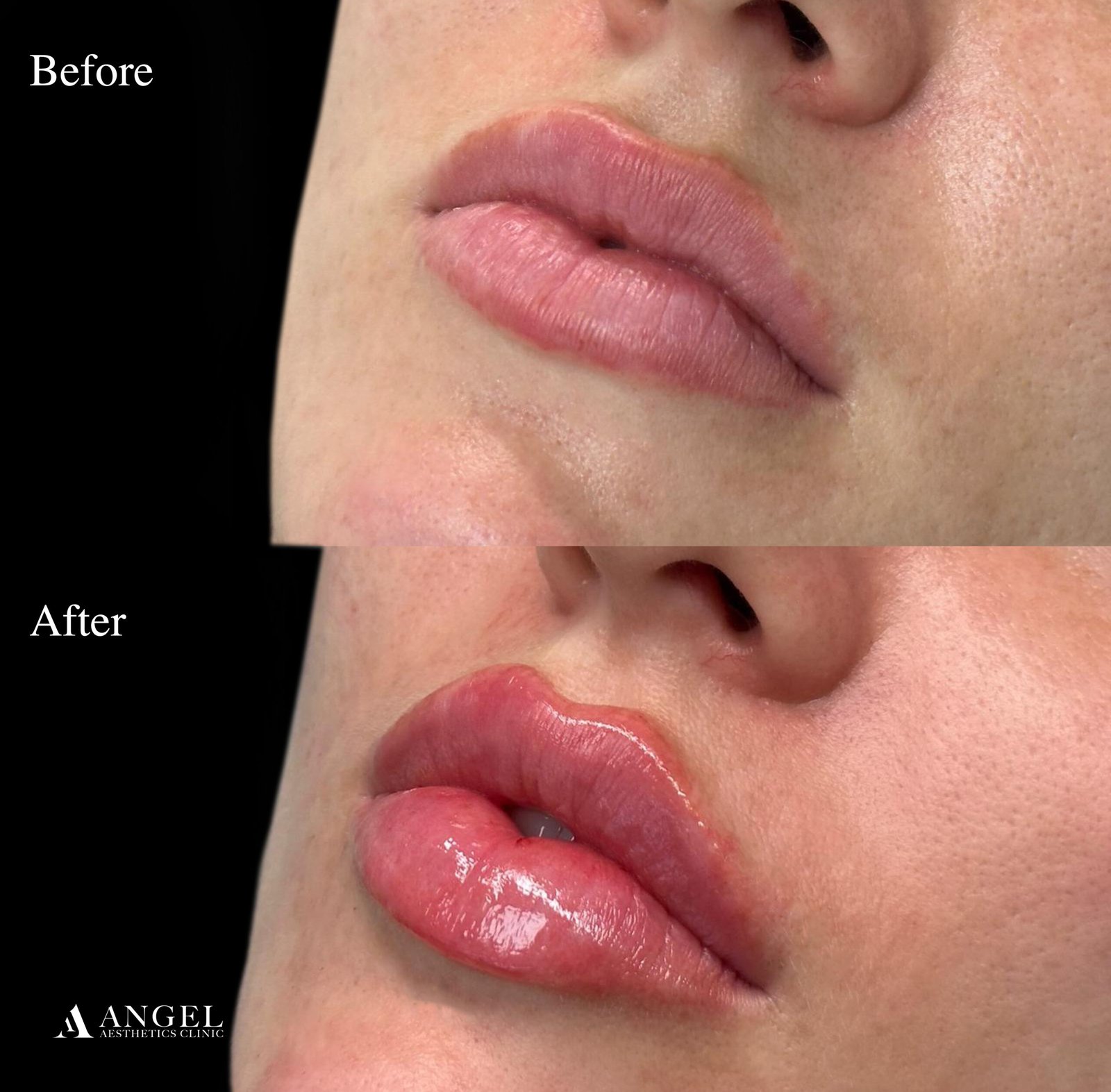 27 Lips Sylvia