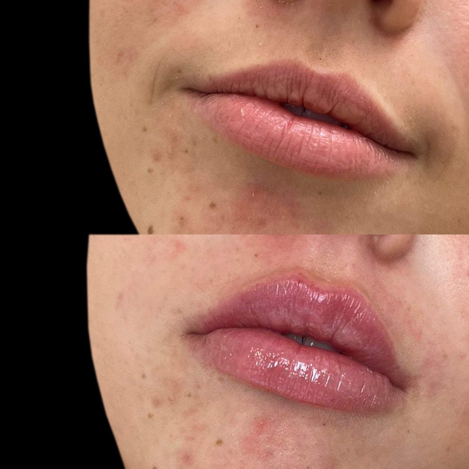 42 Courtney lips